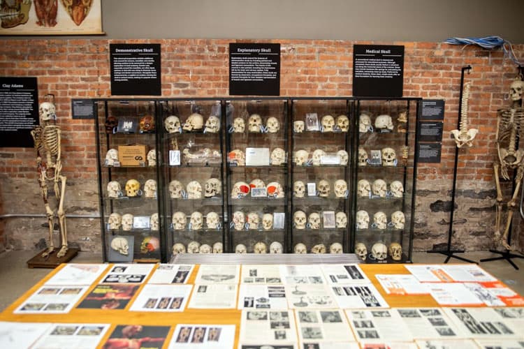 The Bone Museum: Menguak Misteri Osteologi di Brooklyn